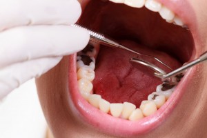 18436282_l-dental treatment