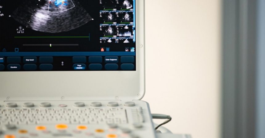 Benefits of Owning a Portable Ultrasound Machine